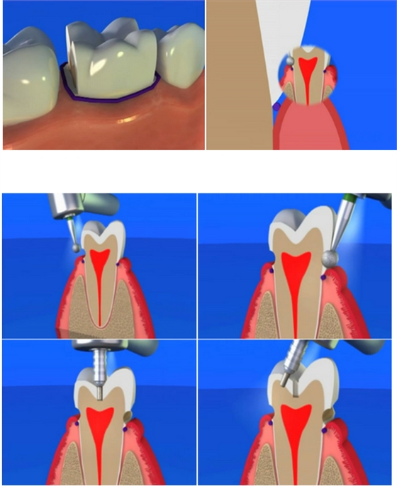 QQ图片20150808092853.png QQ图片20150808092853.png