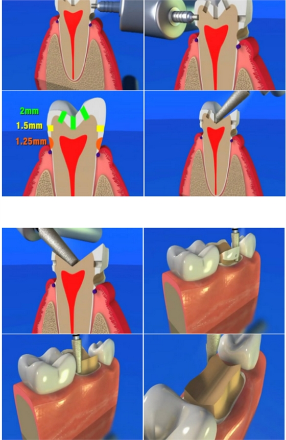 QQ图片20150808092923.png QQ图片20150808092923.png
