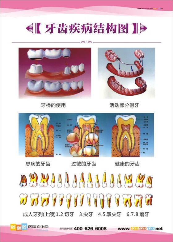 牙齿疾病结果图