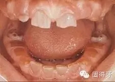 只知道虫牙？快来看看那些你见都没见过的牙病！ 