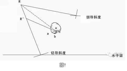 全口义齿五因素十定律详解